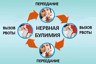 Лечение булимии в Окуловке